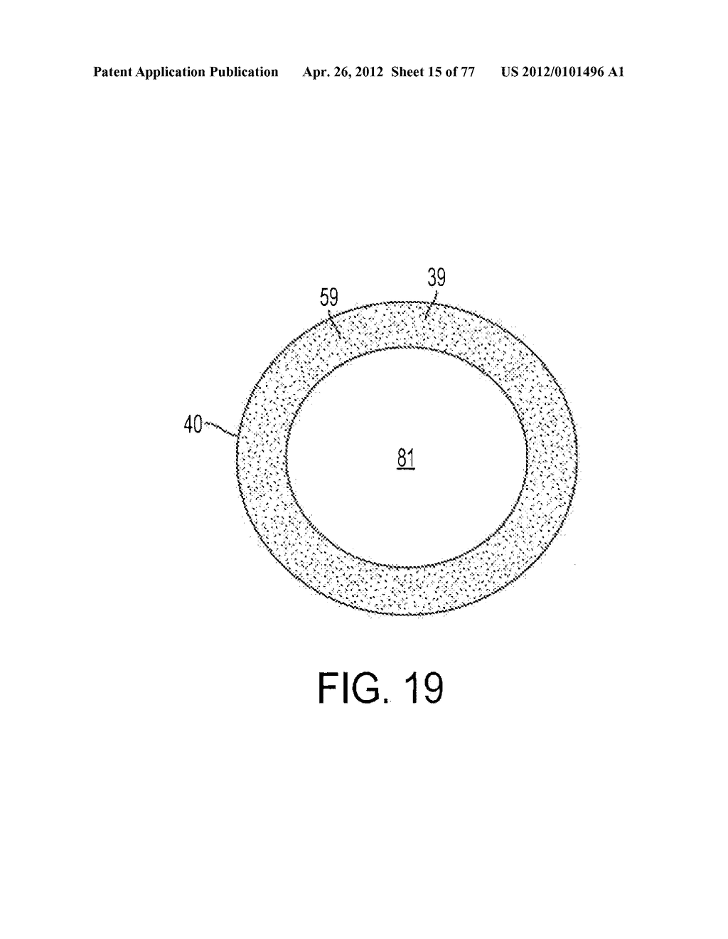 FLUID-ASSISTED MEDICAL DEVICES, SYSTEMS AND METHODS - diagram, schematic, and image 16