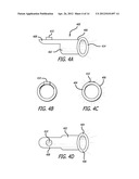 Surgical Pencil Enabling Suction diagram and image