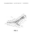 SYSTEMS AND METHODS FOR ENDOMETRIAL ABLATION diagram and image