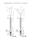 SYSTEMS AND METHODS FOR ENDOMETRIAL ABLATION diagram and image