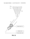 SYSTEMS AND METHODS FOR ENDOMETRIAL ABLATION diagram and image