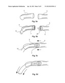 ANASTOMOSIS RING AND ANASTOMOSIS RING ARRANGEMENT diagram and image