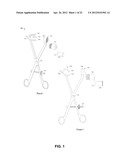FIXATION AND ALIGNMENT DEVICE AND METHOD USED IN ORTHOPAEDIC SURGERY diagram and image