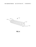 FIXATION AND ALIGNMENT DEVICE AND METHOD USED IN ORTHOPAEDIC SURGERY diagram and image