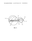 FIXATION AND ALIGNMENT DEVICE AND METHOD USED IN ORTHOPAEDIC SURGERY diagram and image