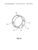 FIXATION AND ALIGNMENT DEVICE AND METHOD USED IN ORTHOPAEDIC SURGERY diagram and image