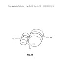 FIXATION AND ALIGNMENT DEVICE AND METHOD USED IN ORTHOPAEDIC SURGERY diagram and image