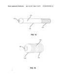 FIXATION AND ALIGNMENT DEVICE AND METHOD USED IN ORTHOPAEDIC SURGERY diagram and image