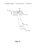 FIXATION AND ALIGNMENT DEVICE AND METHOD USED IN ORTHOPAEDIC SURGERY diagram and image