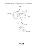 FIXATION AND ALIGNMENT DEVICE AND METHOD USED IN ORTHOPAEDIC SURGERY diagram and image