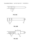 FIXATION AND ALIGNMENT DEVICE AND METHOD USED IN ORTHOPAEDIC SURGERY diagram and image