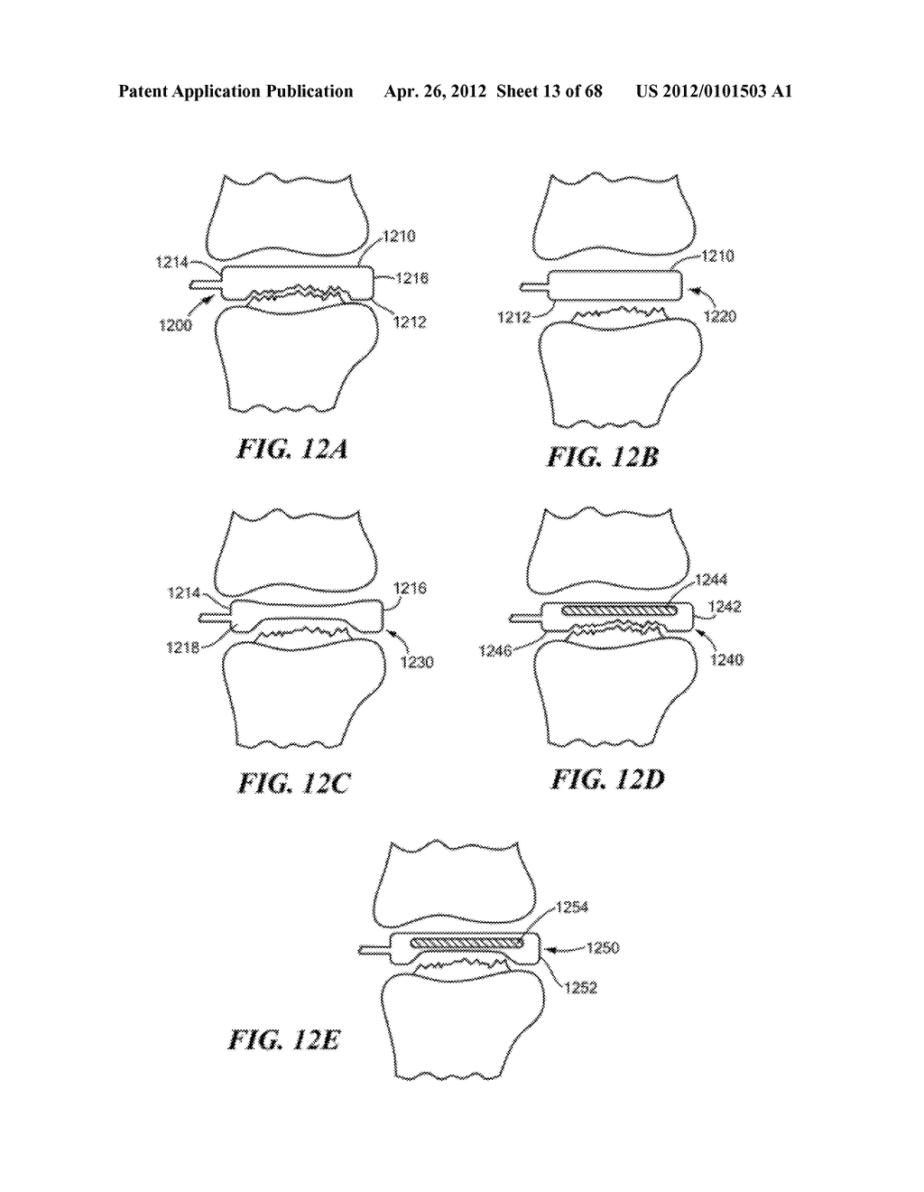 Surgical Tools for Arthroplasty - diagram, schematic, and image 14