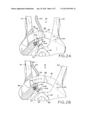 PATELLAR RESECTION INSTRUMENT WITH VARIABLE DEPTH GUIDE diagram and image