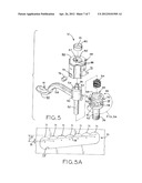 PATELLAR RESECTION INSTRUMENT WITH VARIABLE DEPTH GUIDE diagram and image