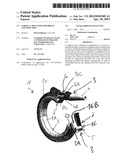 SURGICAL RING WITH ASSEMBLED CONSTRUCTION diagram and image