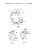 SURGICAL RING WITH ASSEMBLED CONSTRUCTION diagram and image