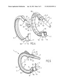 SURGICAL RING WITH ASSEMBLED CONSTRUCTION diagram and image