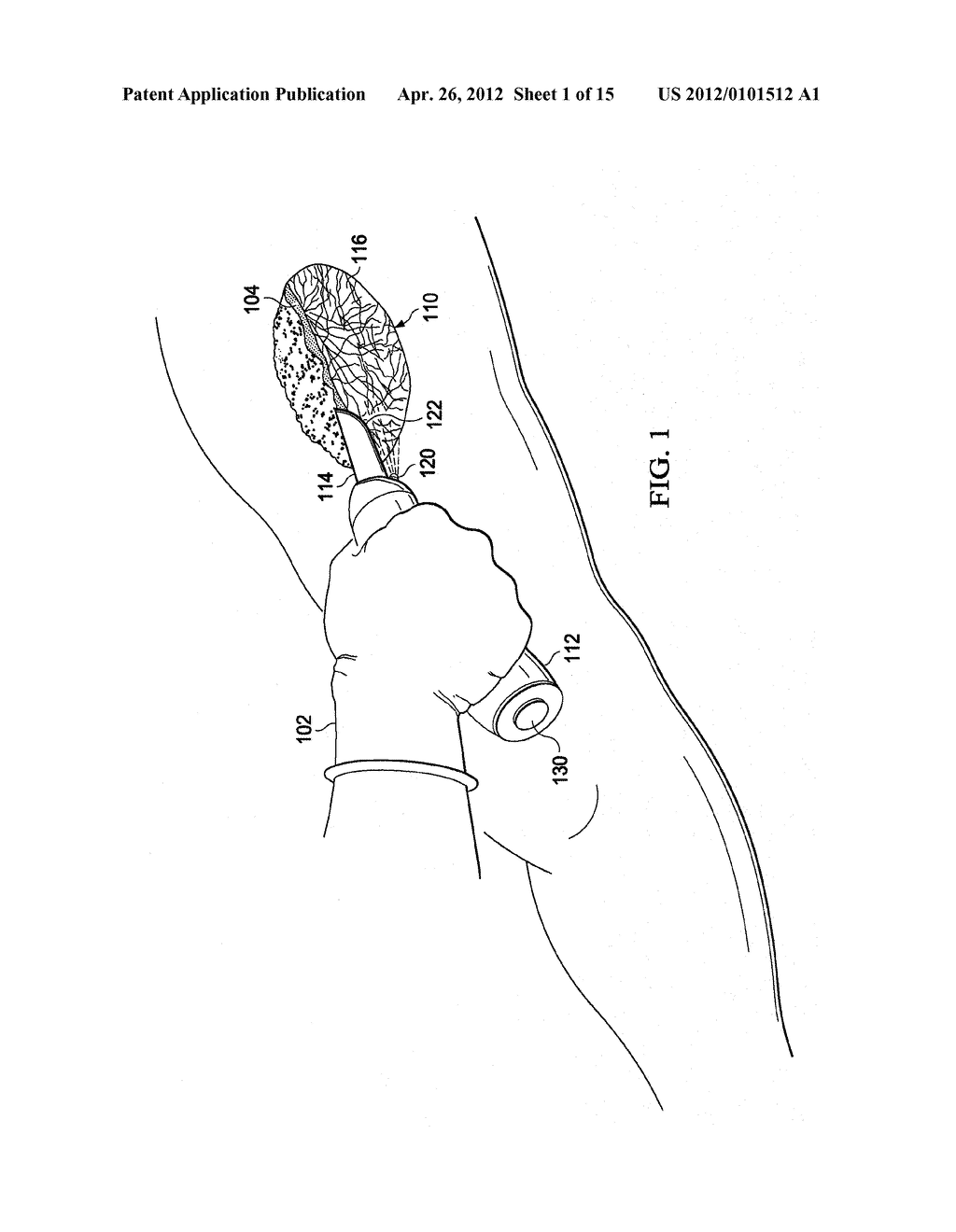 DEBRIDEMENT HAND TOOL - diagram, schematic, and image 02