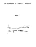 DePond clamp diagram and image