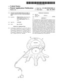 SYSTEM AND METHOD FOR ELECTRICAL STIMULATION OF THE INTERVERTEBRAL DISC diagram and image