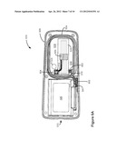 External Controller For an Implantable Medical Device Formed Using a     Sub-Assembly diagram and image