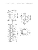 SYSTEMS AND METHODS FOR FIXATING TRANSVENOUSLY IMPLANTED MEDICAL DEVICES diagram and image