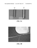 Implantable Electrode with Variable Mechanical Modulation Wiring diagram and image