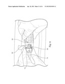 Devices and Methods for Loading a Prosthesis onto a Delivery System diagram and image