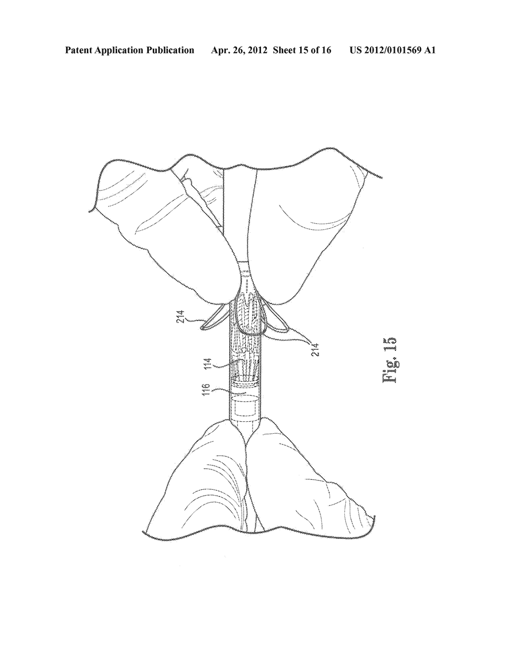 Devices and Methods for Loading a Prosthesis onto a Delivery System - diagram, schematic, and image 16