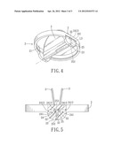 Mechanical Heart Valve Apparatus diagram and image