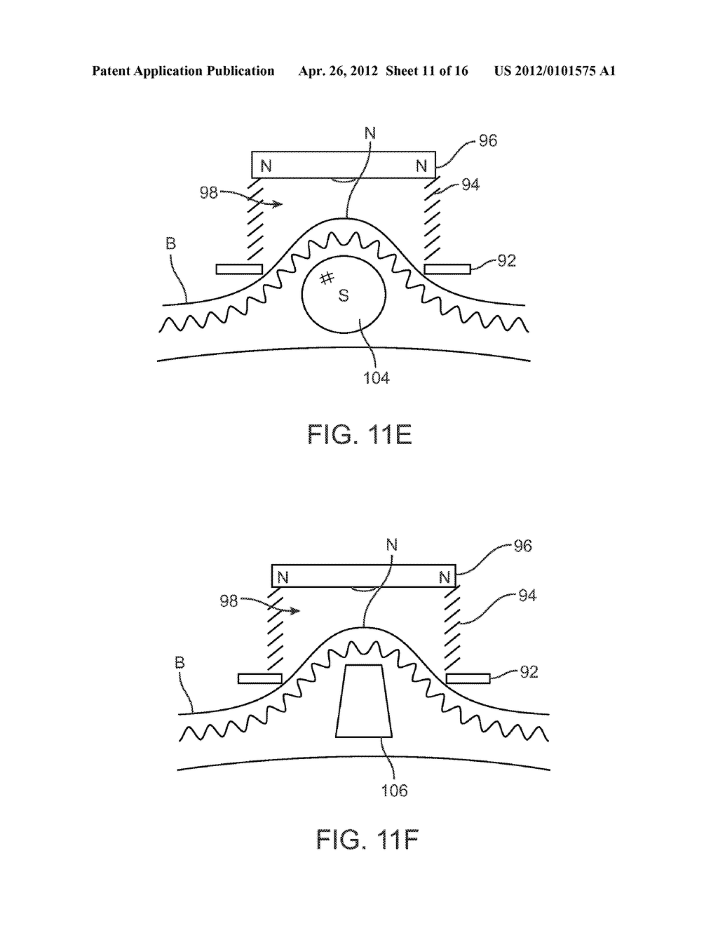 APPARATUS AND METHODS FOR NIPPLE AND BREAST FORMATION - diagram, schematic, and image 12