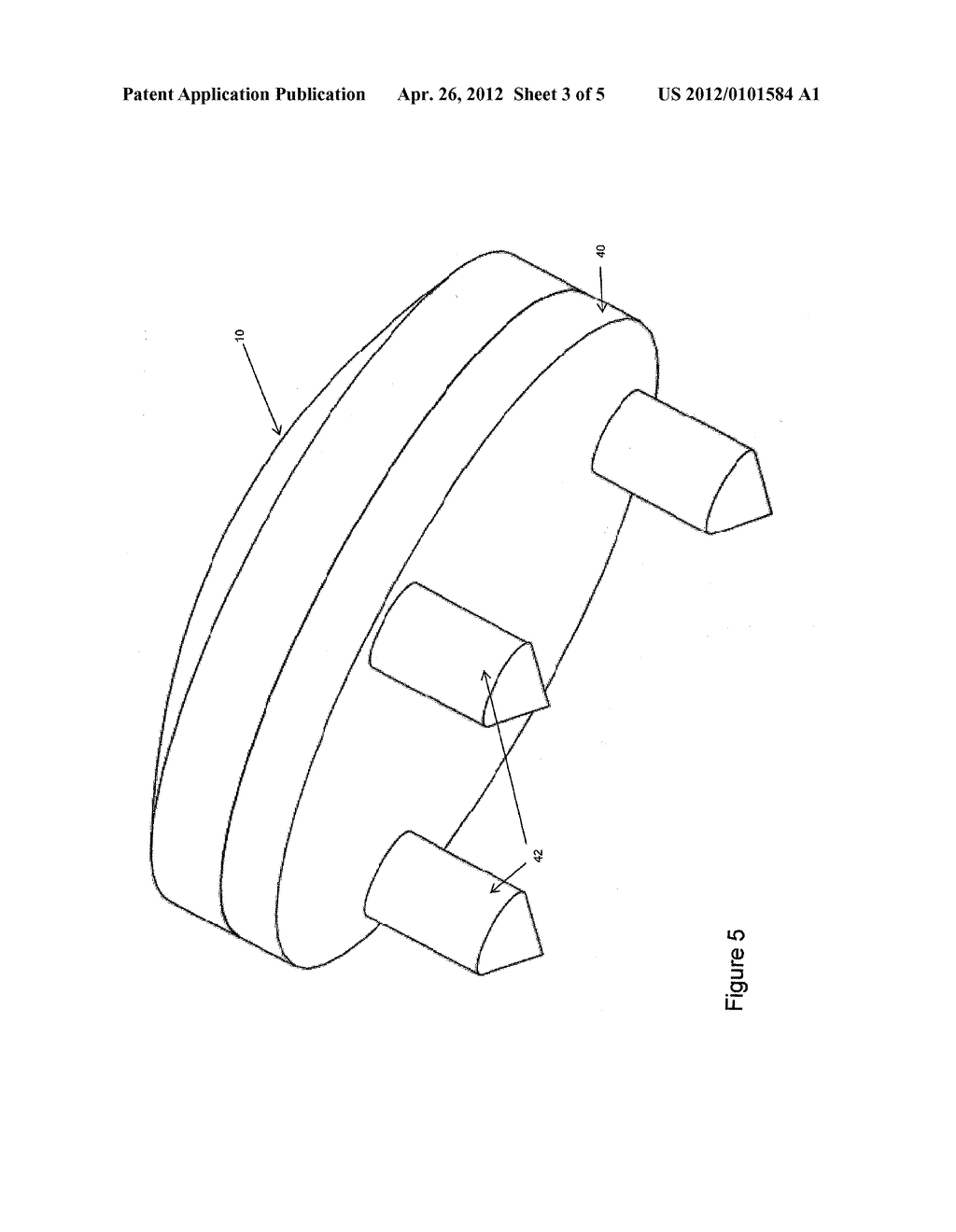 PATELLAR IMPLANT WITH VARIABLE WEIGHTS FOR KNEE REPAIR SURGERY - diagram, schematic, and image 04