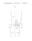 KNEE JOINT DEVICE AND METHOD diagram and image