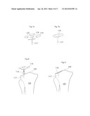 KNEE JOINT DEVICE AND METHOD diagram and image