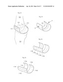 KNEE JOINT DEVICE AND METHOD diagram and image