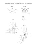 KNEE JOINT DEVICE AND METHOD diagram and image