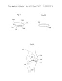 KNEE JOINT DEVICE AND METHOD diagram and image