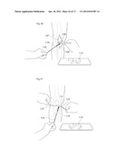 KNEE JOINT DEVICE AND METHOD diagram and image