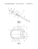 STEM WITH PRESSFIT POROUS ELEMENT diagram and image