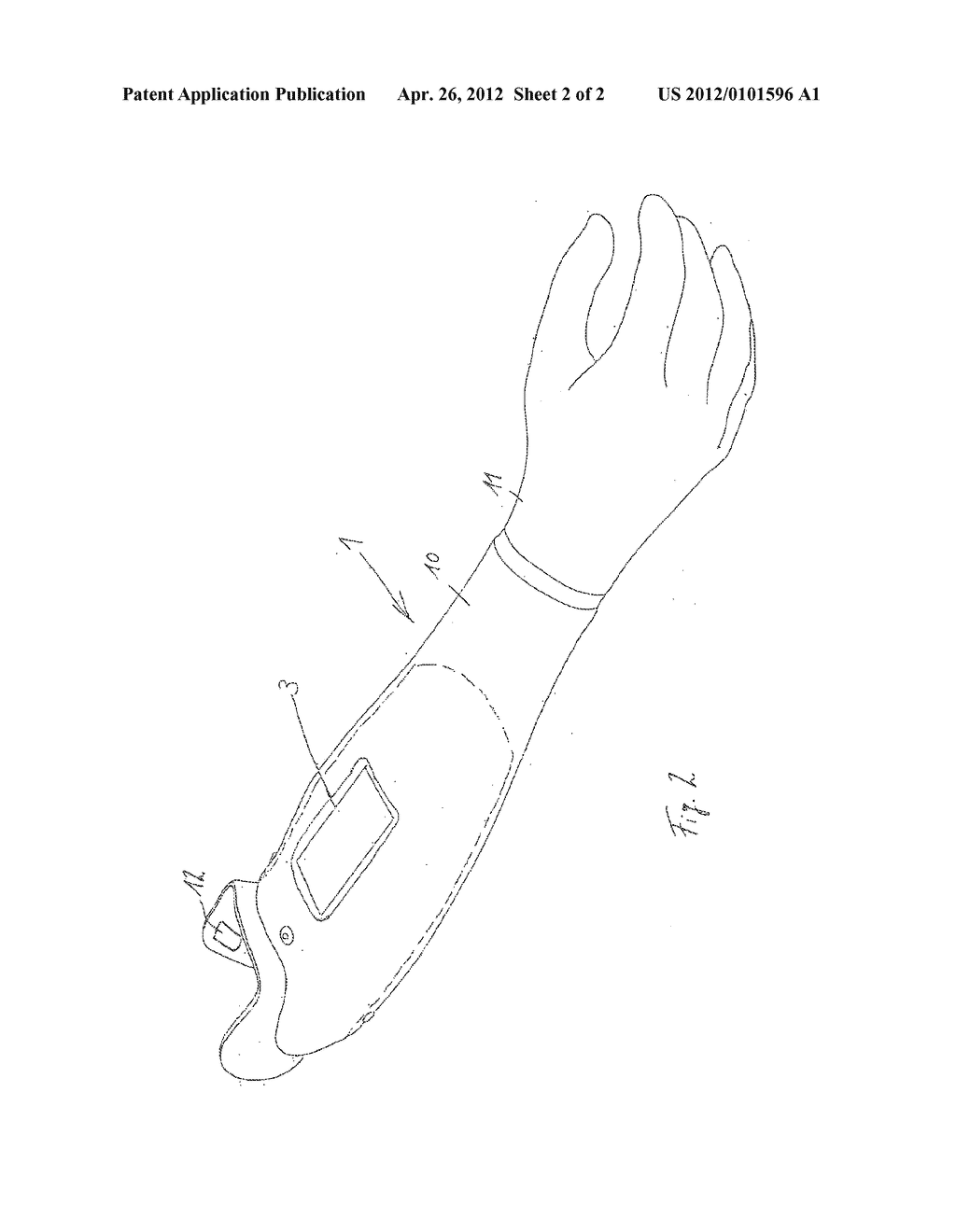 METHOD FOR SETTING UP A CONTROL AND TECHNICAL ORTHOPEDIC DEVICE - diagram, schematic, and image 03