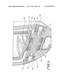 MOMENTUM FREE BEARING FOR USE IN PROSTHETIC AND ORTHOTIC DEVICES diagram and image