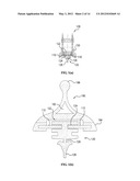 WINDSHIELD WIPER ASSEMBLY diagram and image