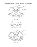 Methods of Making Filter Apparatus and Fabricating a Porous Ceramic     Article diagram and image