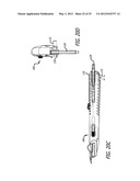 Safety Cutter Apparatus diagram and image
