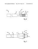 Tool for Removing Object from the Body of a Patient diagram and image