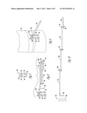 BOW HOLDER diagram and image