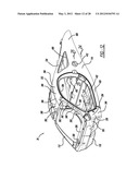 AUTOMOTIVE VEHICLE COMPOSITE BODY STRUCTURE diagram and image