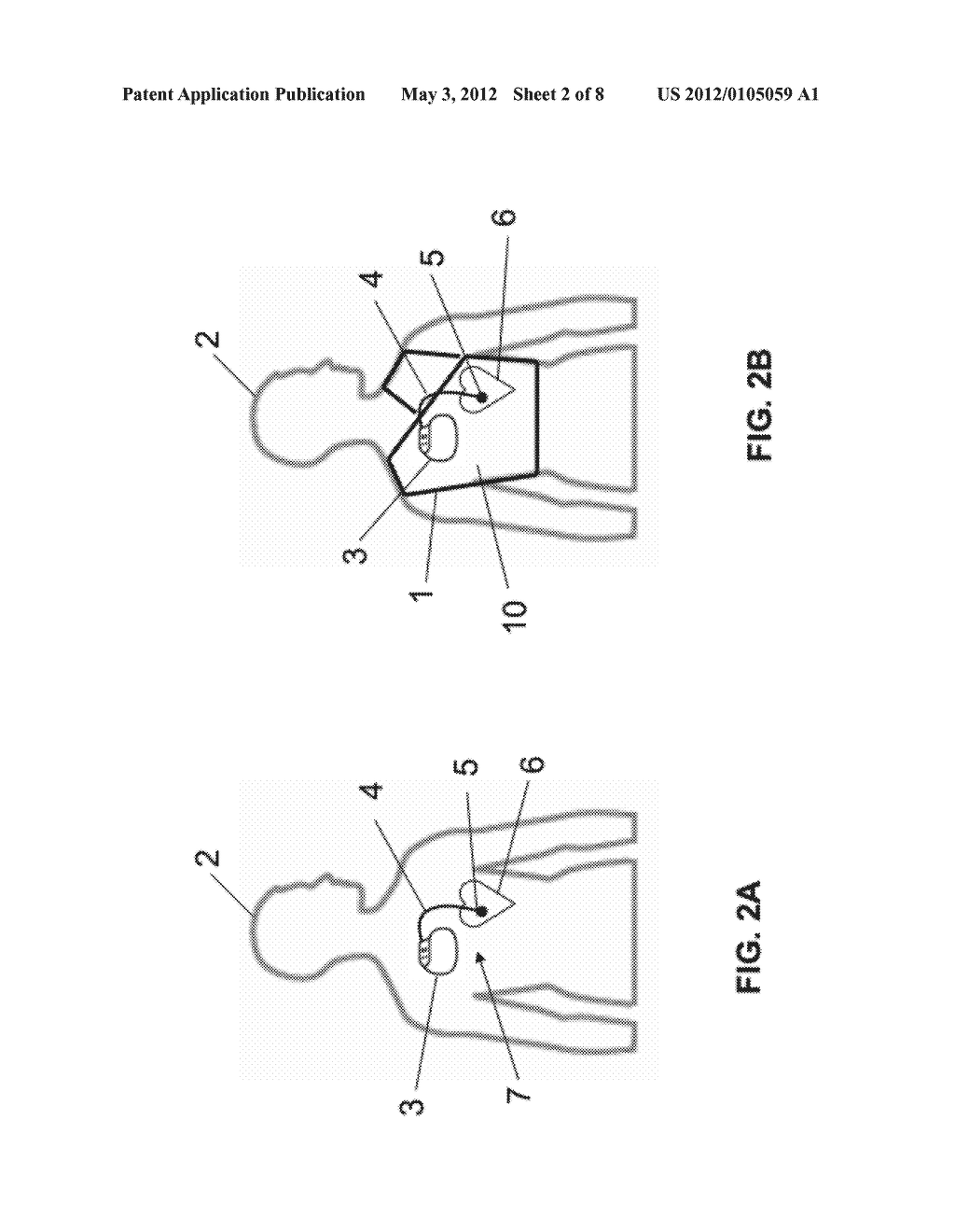 SHIELDING APPARATUS AND SHIELDING STRUCTURES FOR MAGNETIC RESONANCE     IMAGING AND METHOD FOR OPERATING A MAGNETIC RESONANCE IMAGING SCANNER - diagram, schematic, and image 03