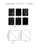 Technique to Enhance the Clinical Efficiency of Radiotherapy and     Radiosurgery Using Perturbative Beaming and Tissue-Specific Radiobiology diagram and image