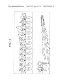 IMAGE PROCESSING APPARATUS, IMAGE PROCESSING METHOD, AND PROGRAM diagram and image